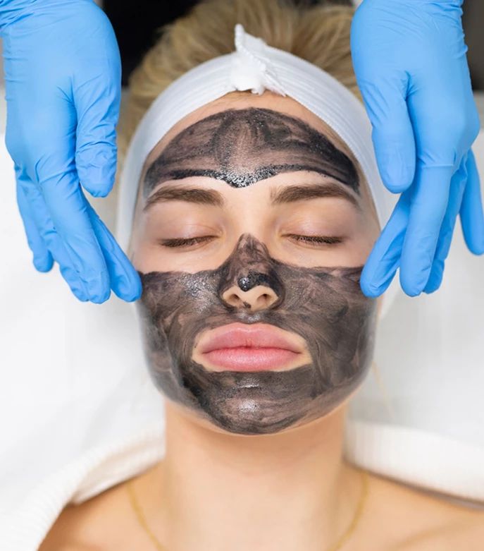 Carbon Peeling Rezultate