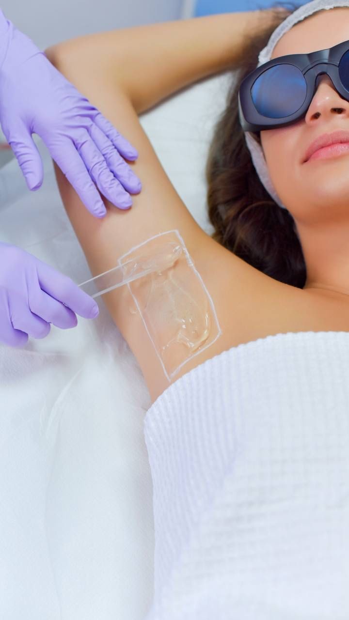 Epilare Laser Rezultate